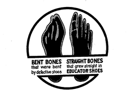 BENT BONES THAT WERE BENT BY DEFECTIVE SHOES STRAIGHT BONES THAT GREW STRAIGHT IN EDUCATOR SHOES trademark