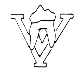 V trademark