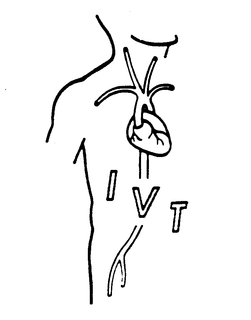 IVT trademark