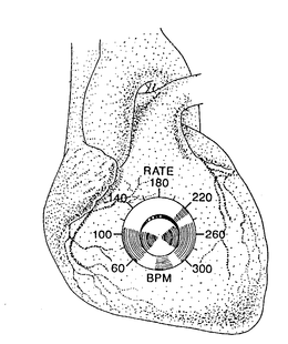 RATE BPM 60 100 140 180 220 260 300 trademark
