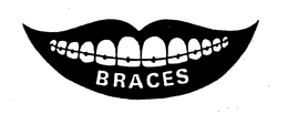 BRACES trademark