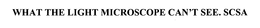 WHAT THE LIGHT MICROSCOPE CAN'T SEE. SCSA trademark