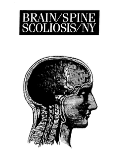 BRIAN/SPINE SCOLIOSIS/NY trademark