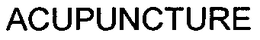 ACUPUNCTURE trademark