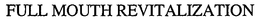 FULL MOUTH REVITALIZATION trademark