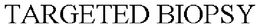 TARGETED BIOPSY trademark