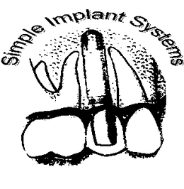 SIMPLE IMPLANT SYSTEMS trademark