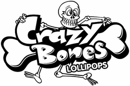 CRAZY BONES LOLLIPOPS trademark