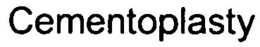 CEMENTOPLASTY trademark