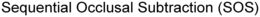 SEQUENTIAL OCCLUSAL SUBTRACTION (SOS) trademark