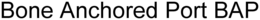 BONE ANCHORED PORT BAP trademark
