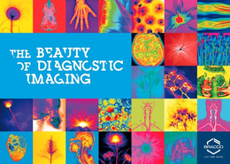 THE BEAUTY OF DIAGNOSTIC IMAGING BRACCOLIFE FROM INSIDE trademark