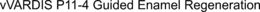 VVARDIS P11-4 GUIDED ENAMEL REGENERATION trademark
