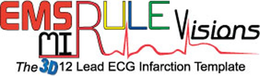 EMS MI RULE VISIONS THE 3D 12 LEAD ECG INFARCTION TEMPLATE trademark