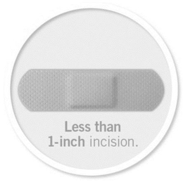 LESS THAN 1-INCH INCISION trademark