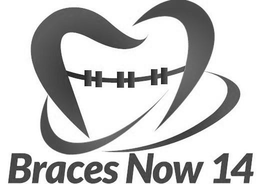 BRACES NOW 14 trademark