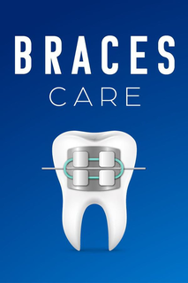 BRACES CARE trademark